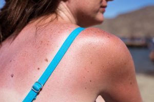 Segni del costume: 5 astuzie per nasconderli