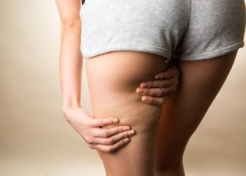 primo piano delle gambe di una donna con shorts grigio che esegue con le mani un massaggio anticellulite per drenare le gambe