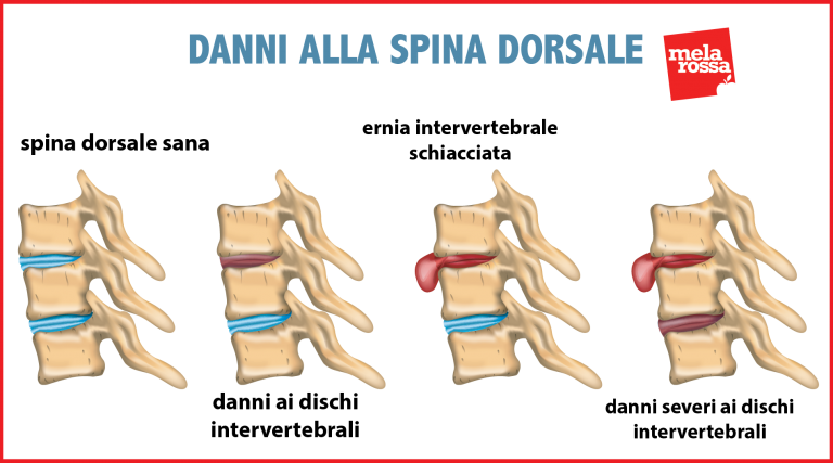 Ha Il Corpo Diviso In Tanti Anelli
