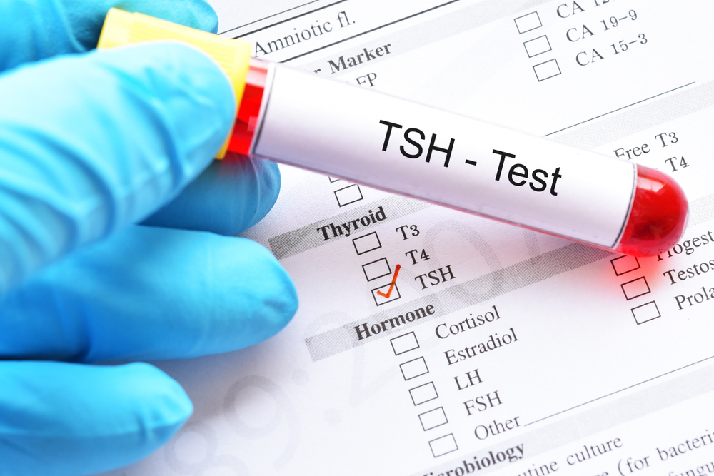 Tiroide: TSH test