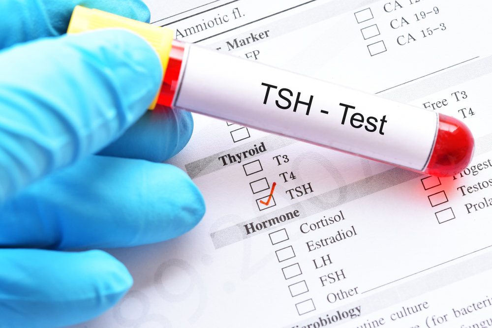 Tiroide: TSH test