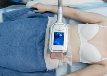Piano dall'alto della pancia di una donna con un apparecchio di criolipolisi sulla pancia . E' in reggiseno e ha un asciugamano blu sulle gambe