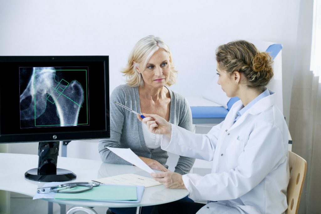 osteoporosi: cos'è e come si cura