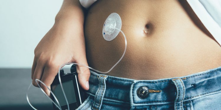 complicanze del diabete.