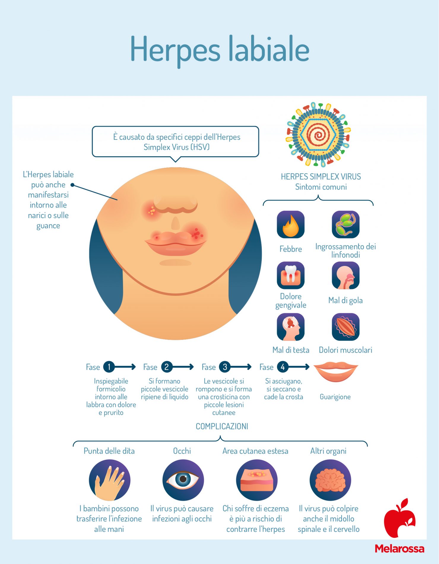 Herpes labiale: sintomi, diagnosi, cura e alimentazione