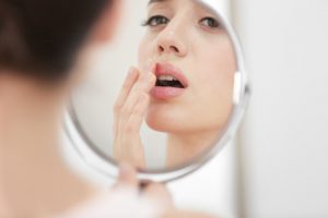 Herpes labiale: sintomi, diagnosi e cura