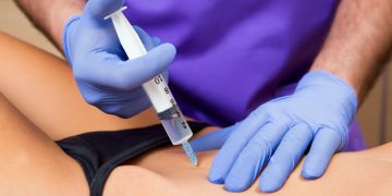 mesoterapia