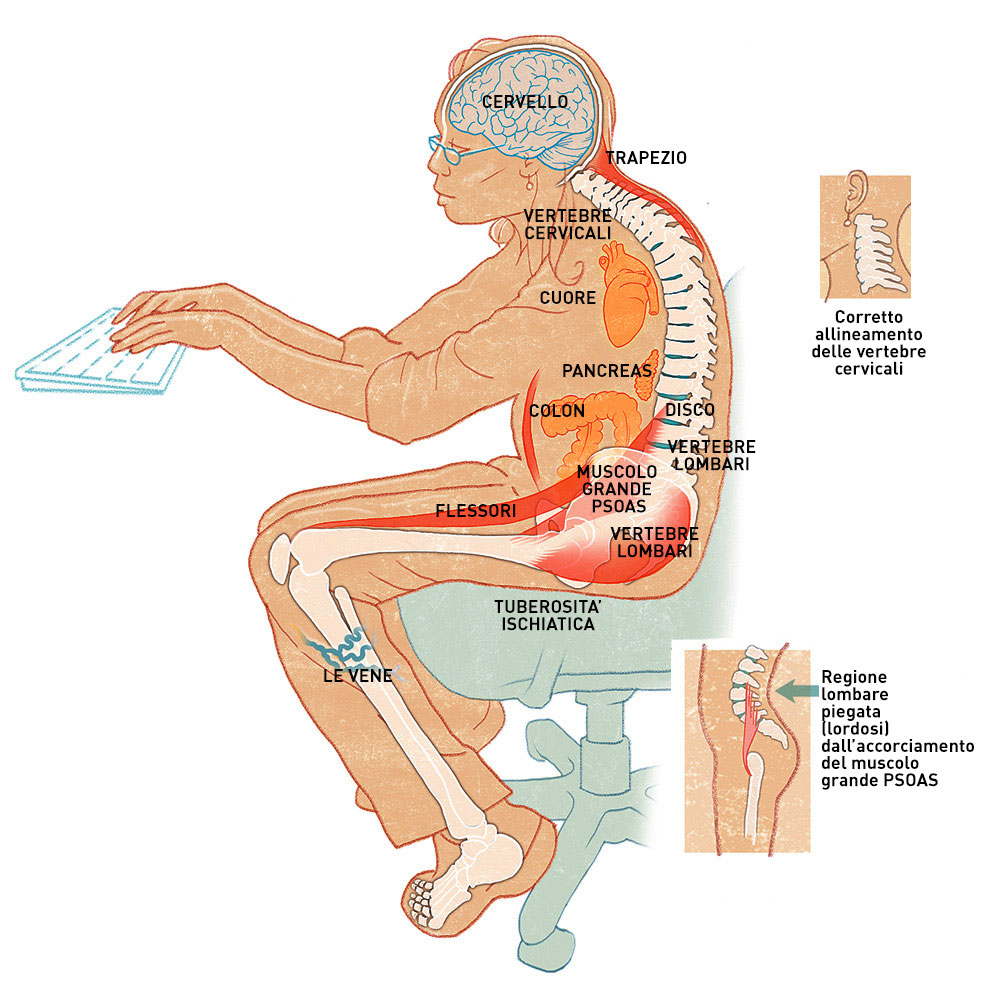 psoas contratto: conseguenza per salute