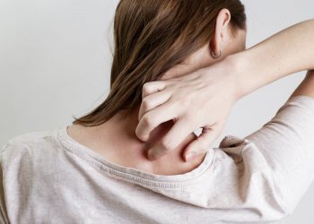 psoriasi: attenzione alle notizie fuorivianti dal web