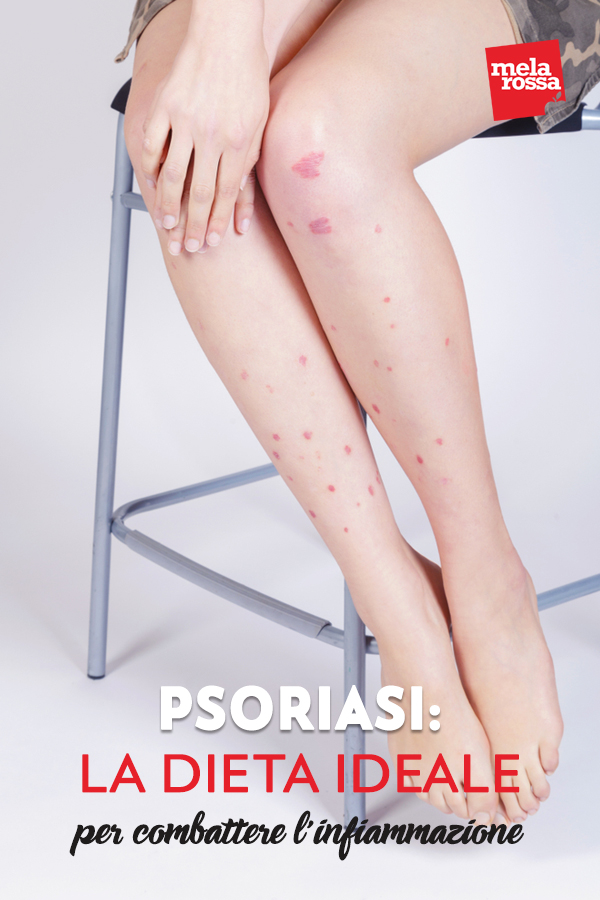 psoriasi: la dieta ideale