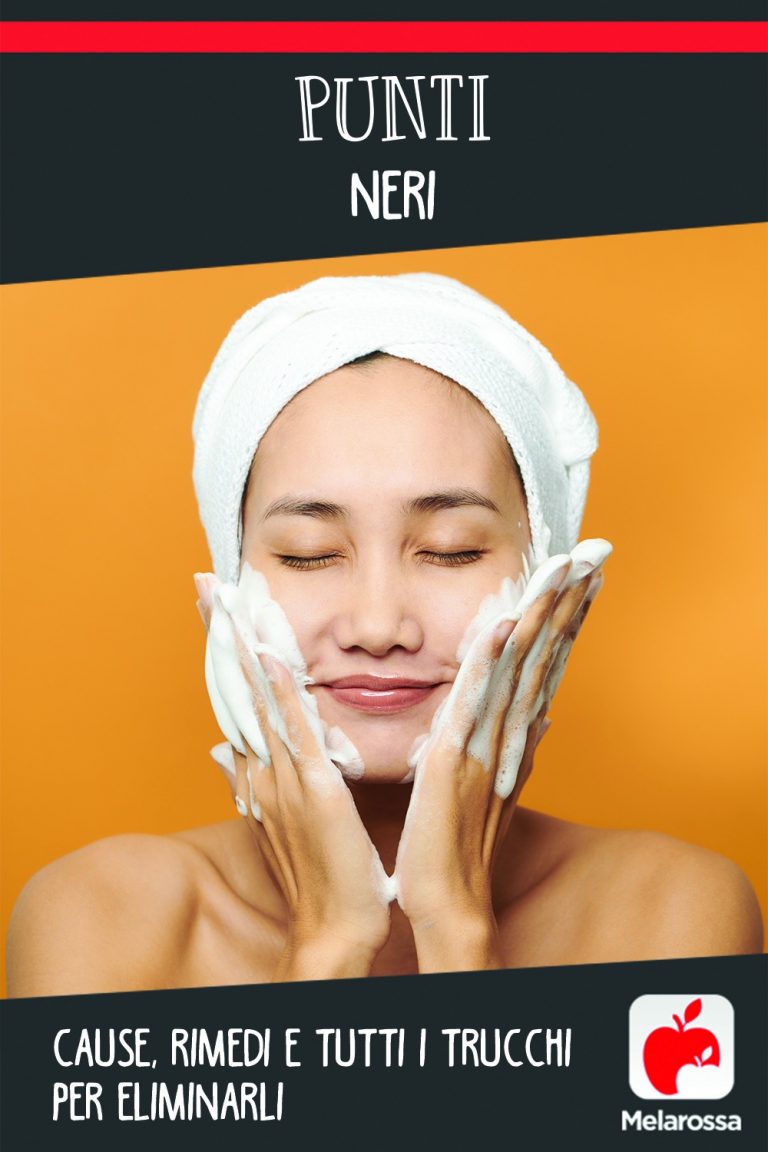 Punti neri cause, rimedi e tutti