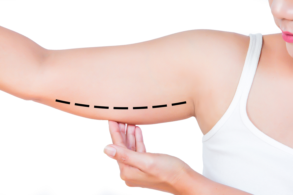esercizi per le braccia e trattamenti estetici