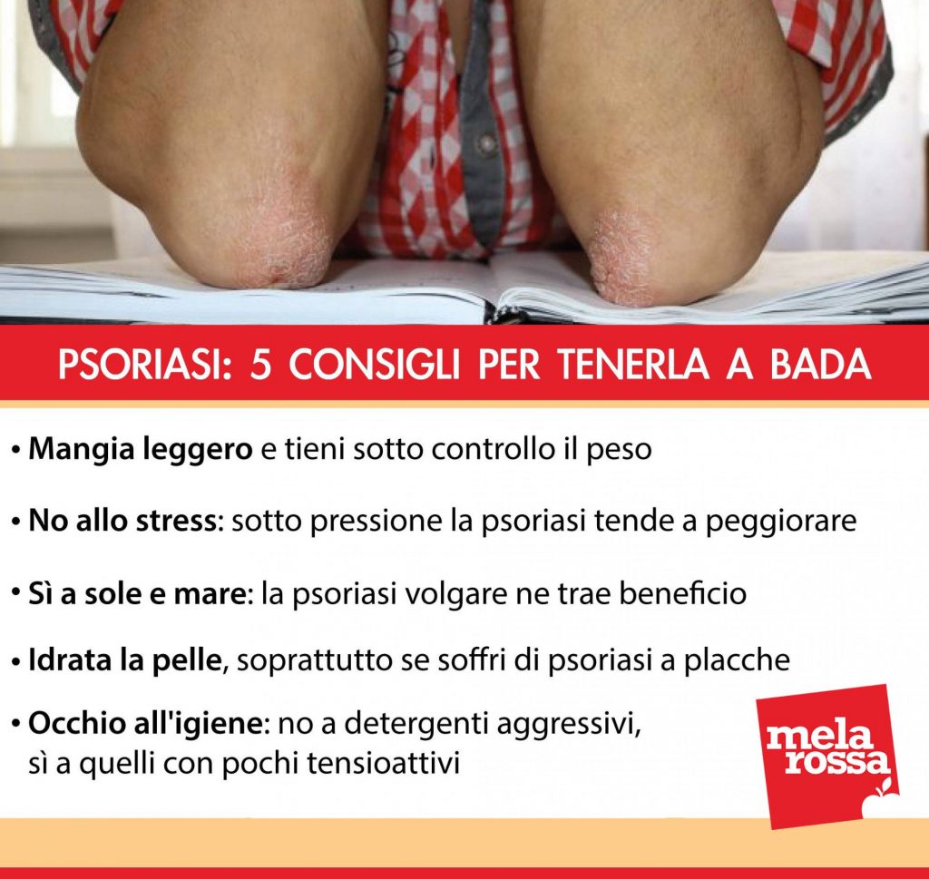 psoriasi; curarsi con alimentazione