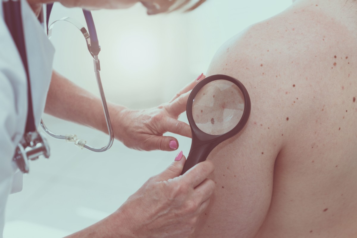 psoriasi: diagnosi