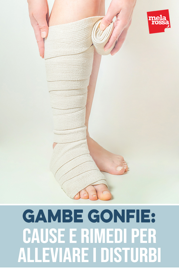gambe gonfie: cause, rimedi e quando consultare
