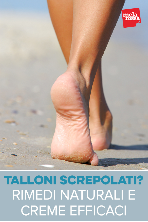 talloni-screpolati