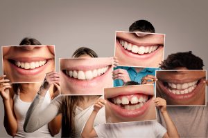 Denti: se sono in salute, anche il cuore sta bene