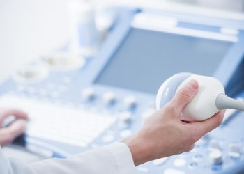 Un medico che tiene in mano il cursore dell'ecodoppler