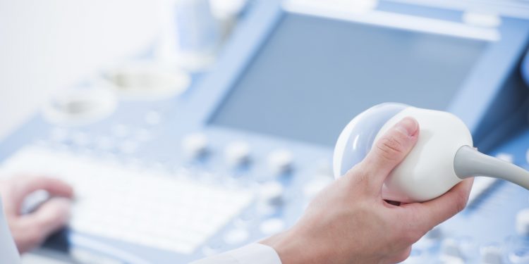 Un medico che tiene in mano il cursore dell'ecodoppler