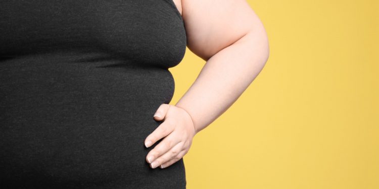 emicrania e obesità, scoperto il legame