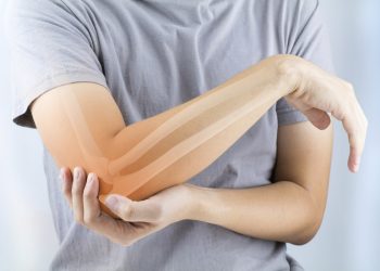 Osteoporosi: latte, tonno e rucola per mantenere in salute le tue ossa