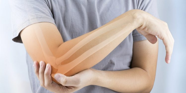 Osteoporosi: latte, tonno e rucola per mantenere in salute le tue ossa