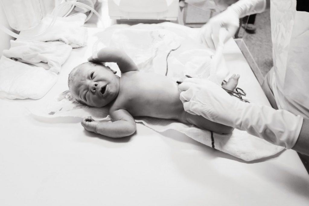 neonati prematuri: meno rischi con parto in unità specializzata