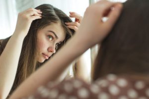 Bellezza 1 Mai più capelli con la forfora grazie al catrame minerale