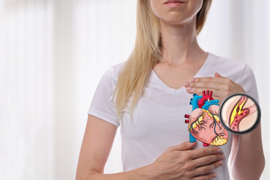 colesterolo LDL: proteine B maggiore rischio cuore