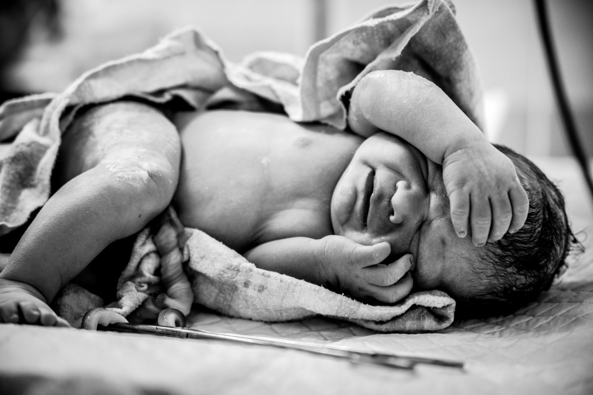 parto cesareo cosa sente il bambino
