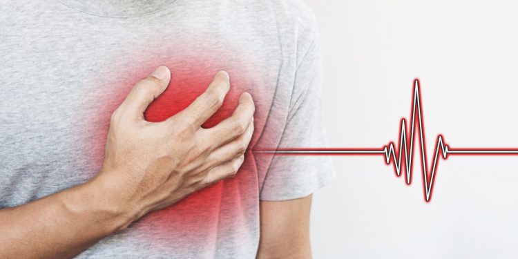 Il colesterolo alto aumenta il rischio di infarto e ictus, specie tra gli under 45