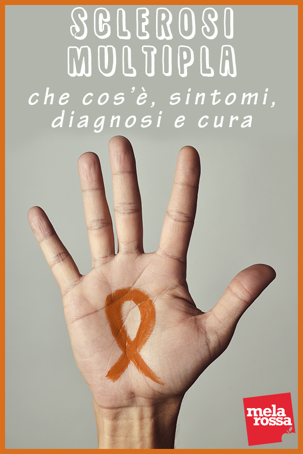 sclerosi multipla: che cos'è. sintomi, cause e cura