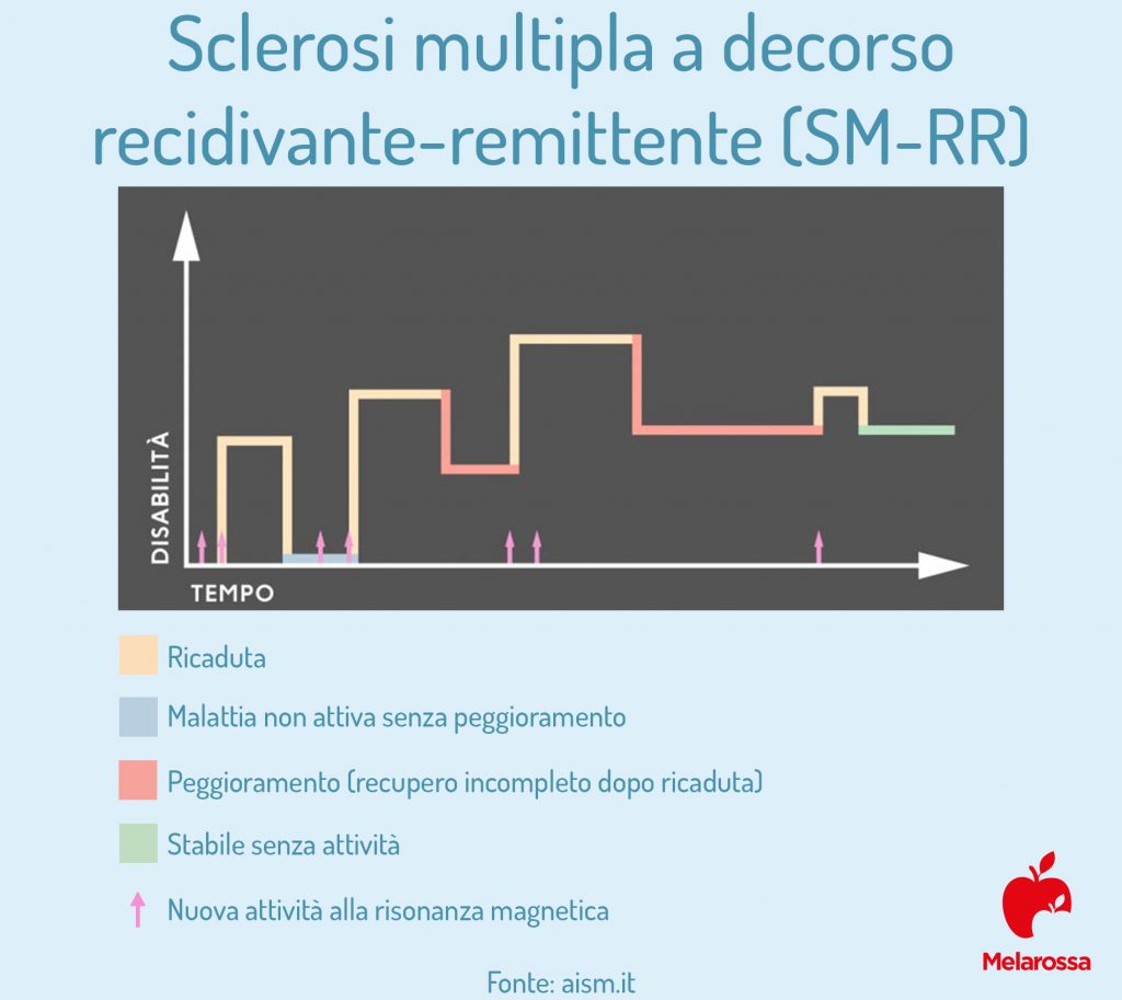 Sclerosi multipla decorso recidivante remittente