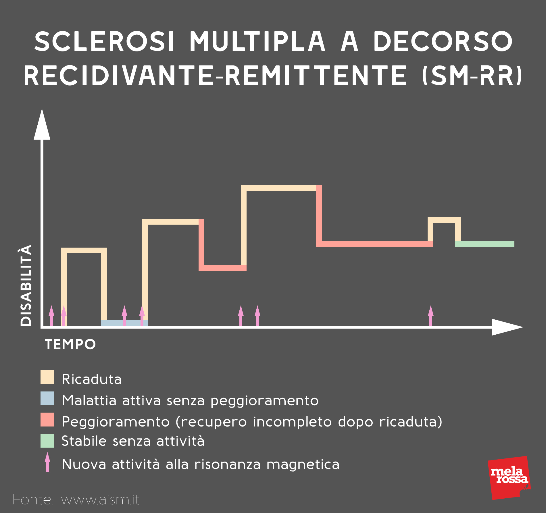 sclerosi multipla a decorso recidivante remittente