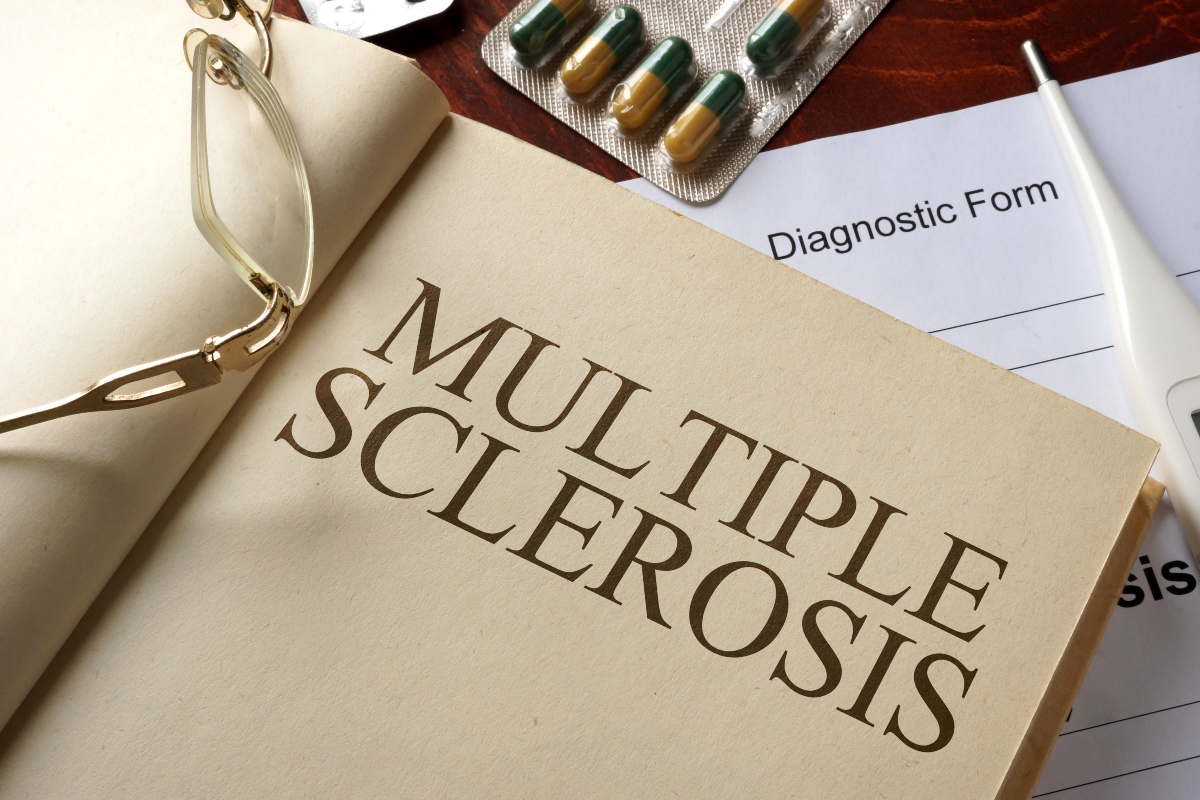 Sclerosi multipla diagnosi