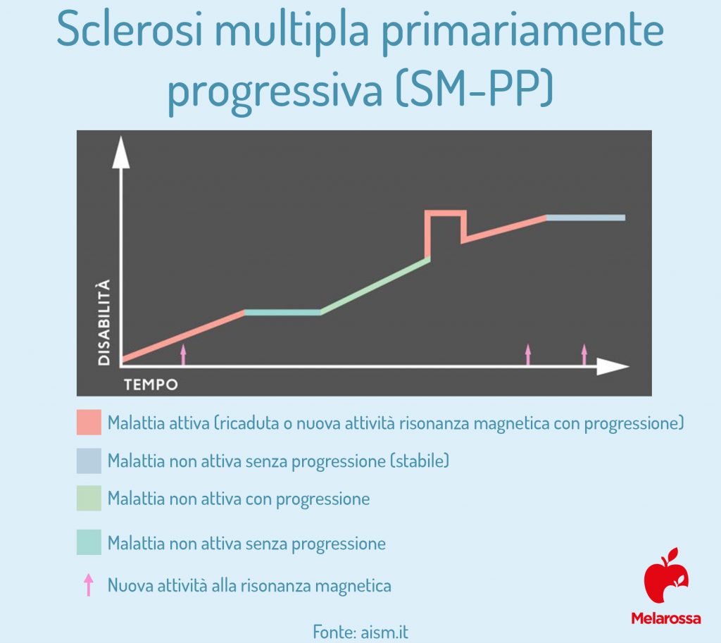 Sclerosi Multipla primariamente progressiva