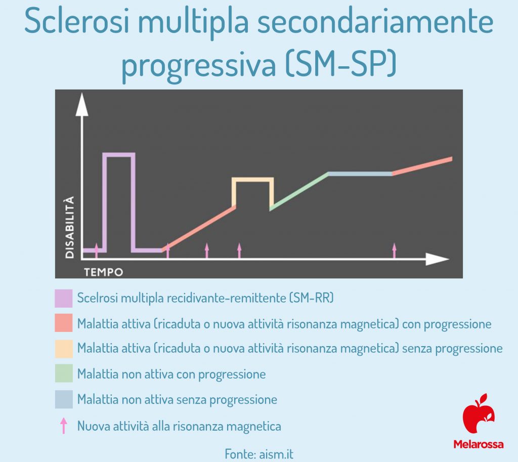 Sclerosi multipla secondariamente progressiva
