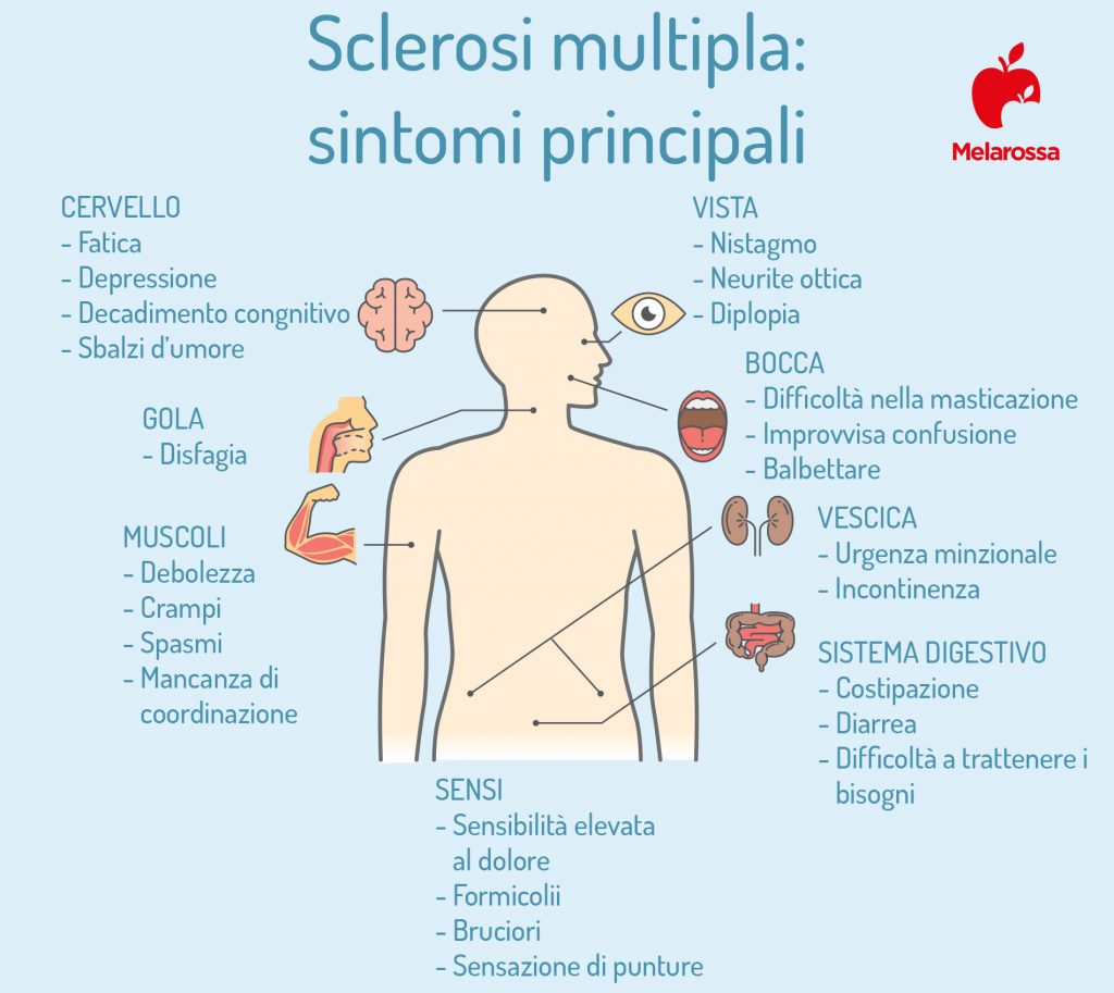 Sclerosi multipla: i sintomi