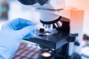 Tumore del colon, scoperte cellule dormienti che resistono alle cure: passo avanti per lo sviluppo di terapie più efficaci