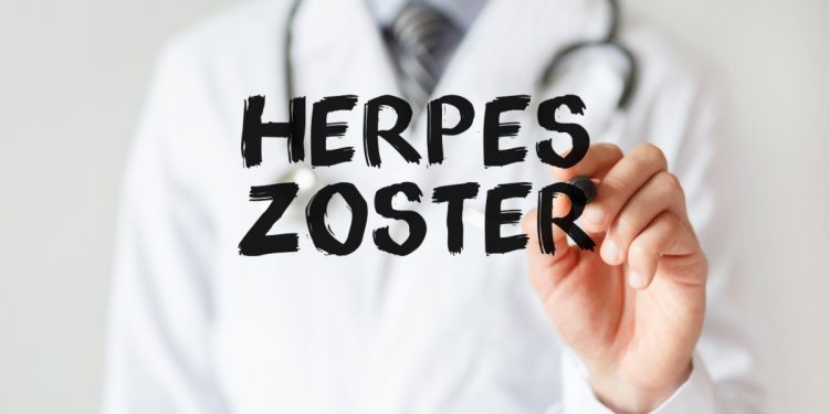 herpes zoster: cos'è, cause, sintomi, complicazioni e cura,