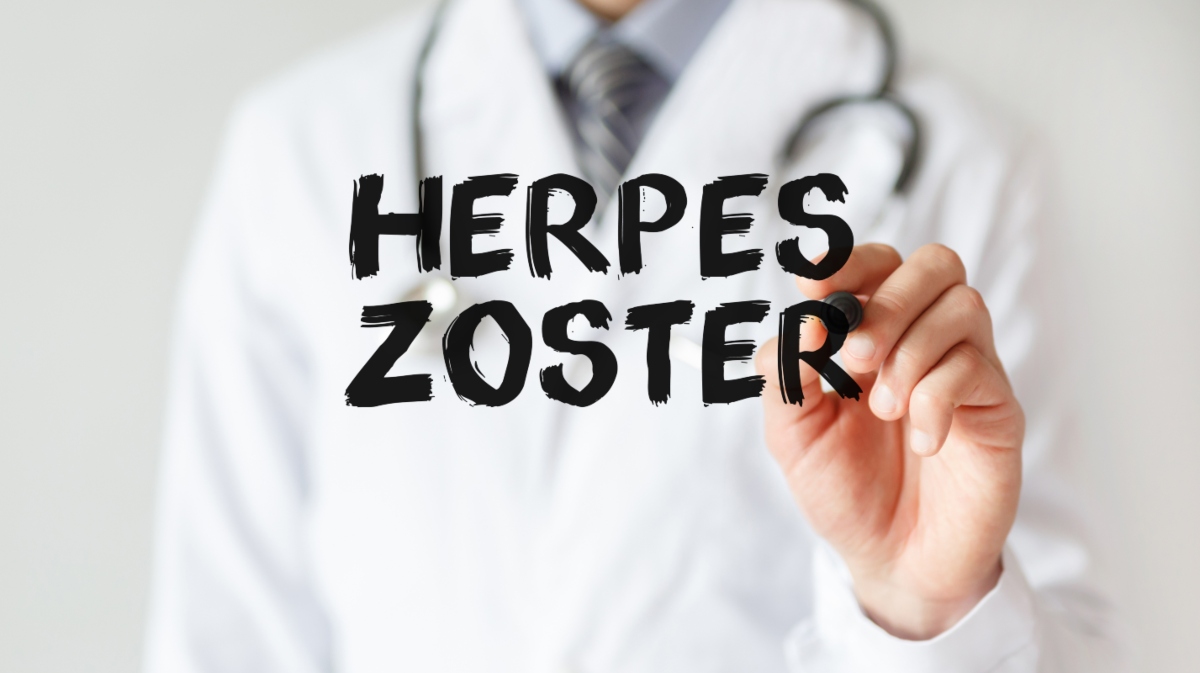 herpes zoster: cos'è, cause, sintomi, complicazioni e cura,