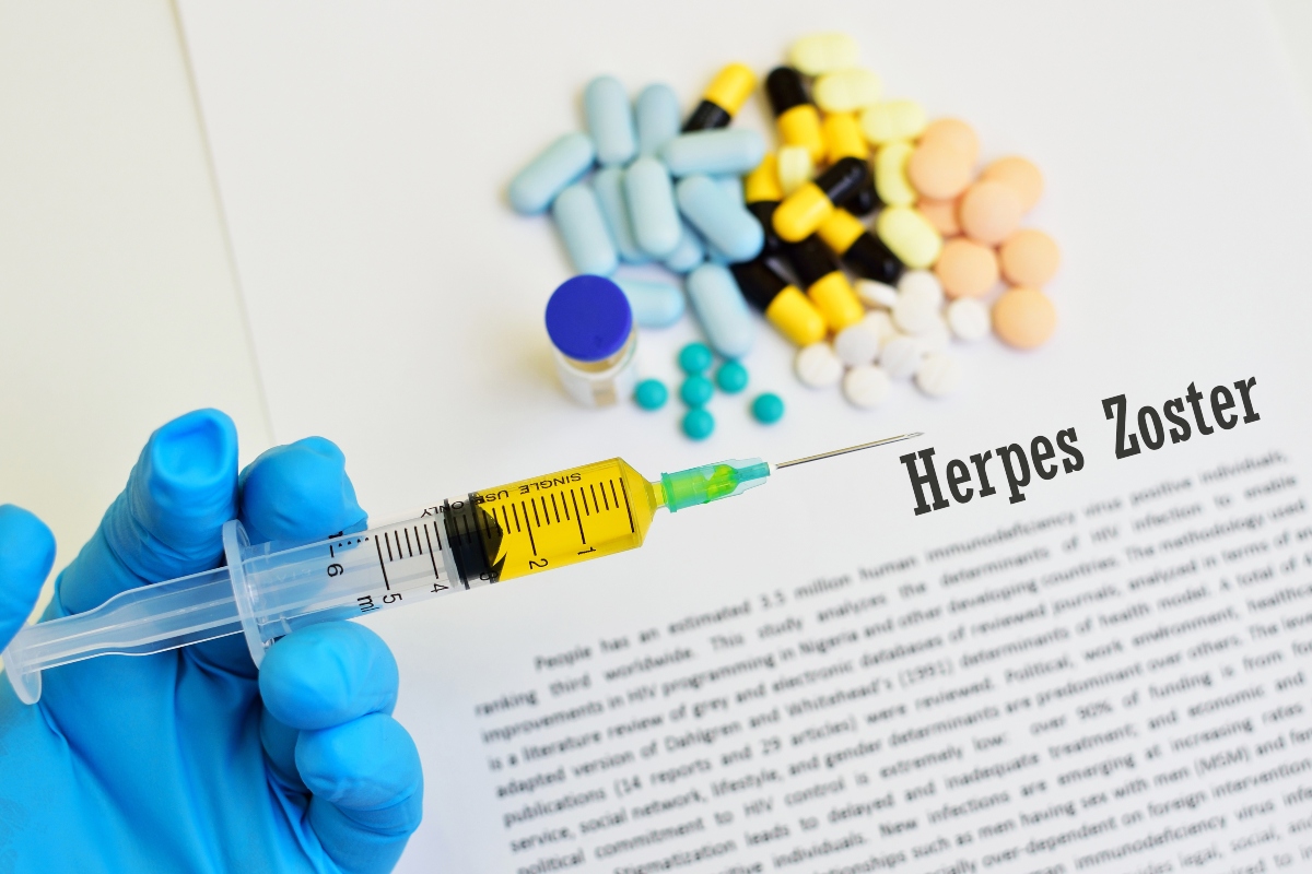 herpes zoster: cura