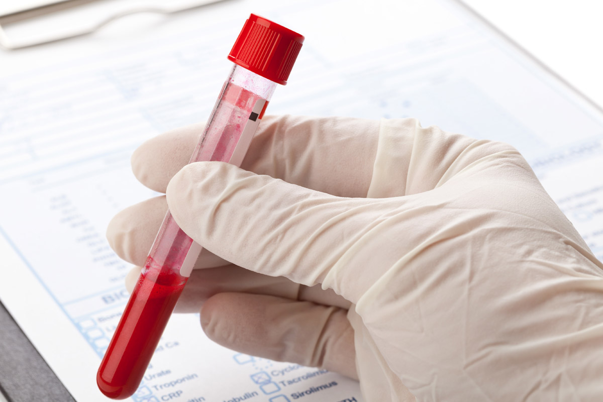 test sangue per prevedere inizio menopausa