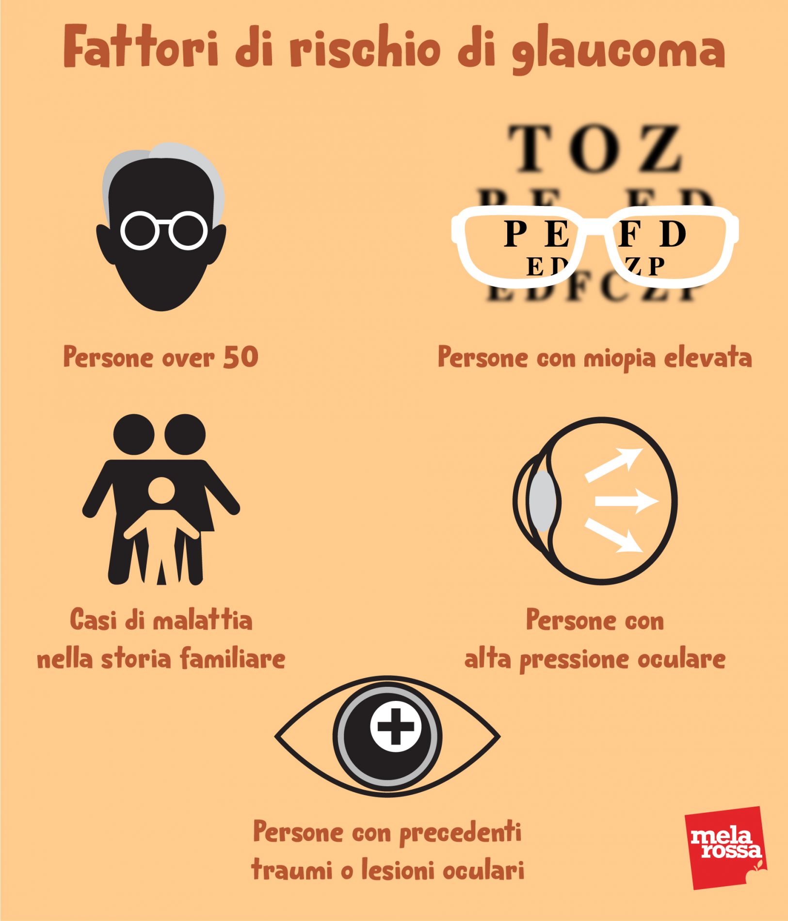 fattori di rischio del glaucoma 