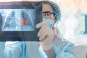 Coronavirus: attuali terapie e prevenzione. I consigli dello pneumologo