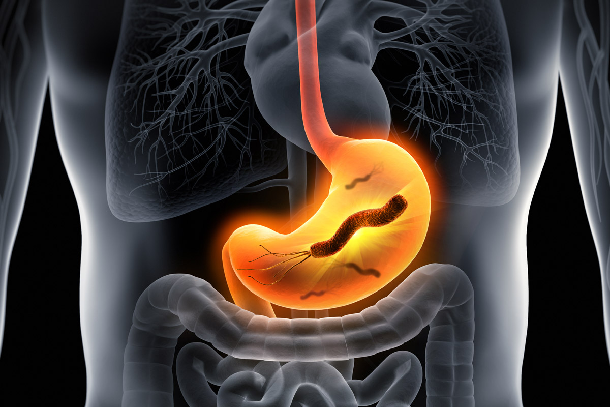 Helicobacter Pylori: cos'è, contagio, sintomi, complicanze, test e cure 2 Helicobacter batterio stomaco