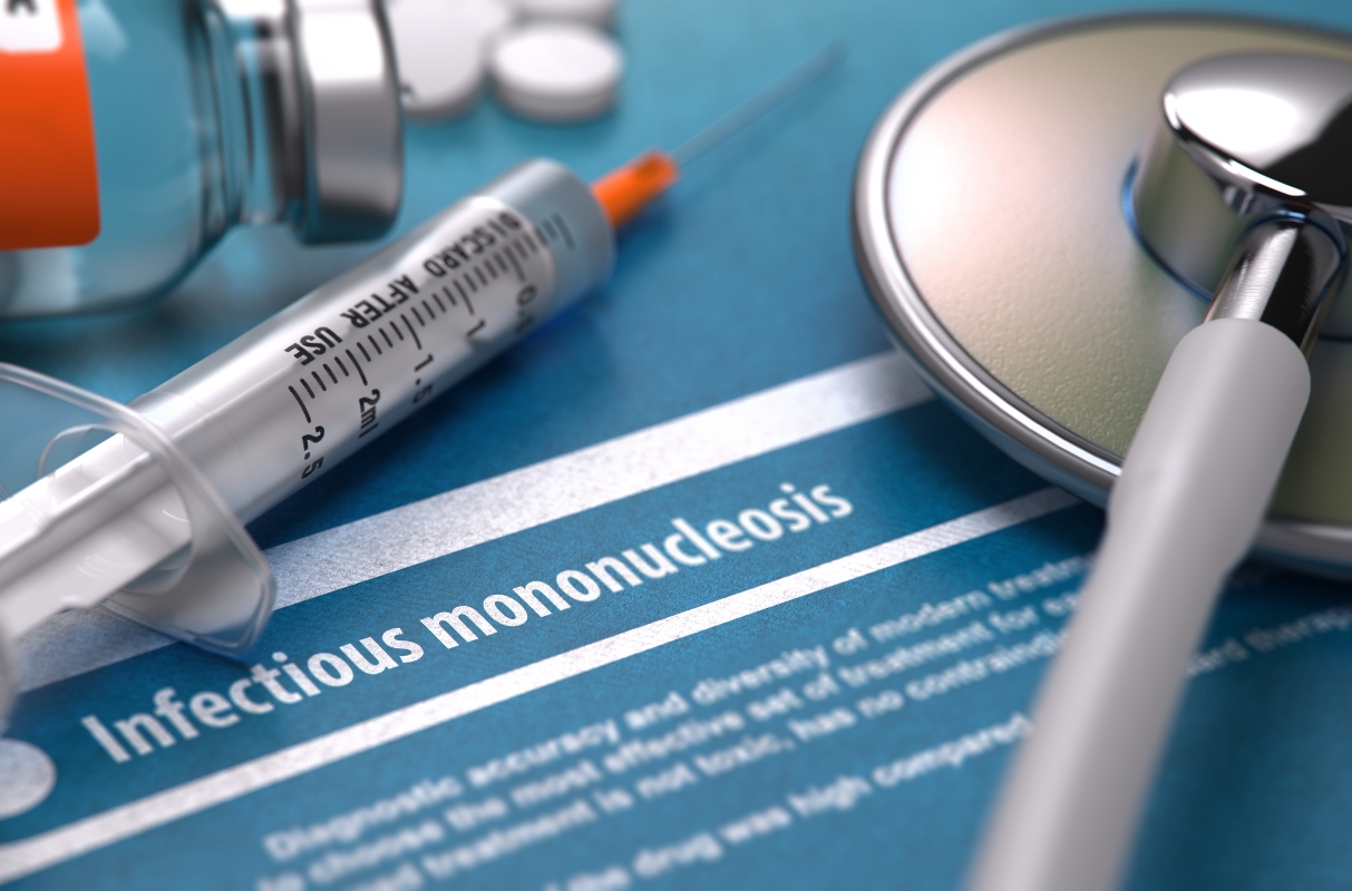 mononucleosi: diagnosi