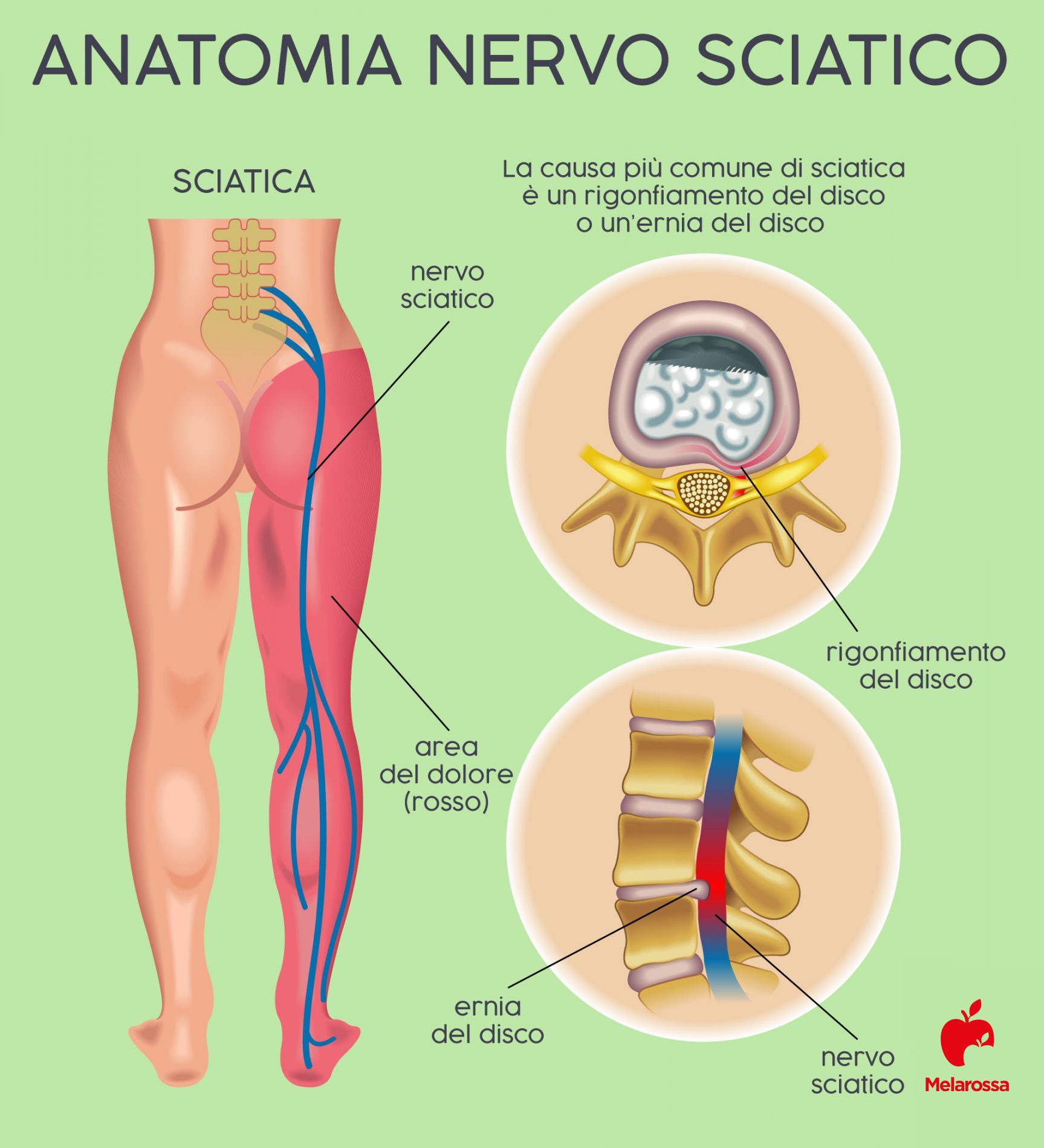 nervo sciatico: anatomia