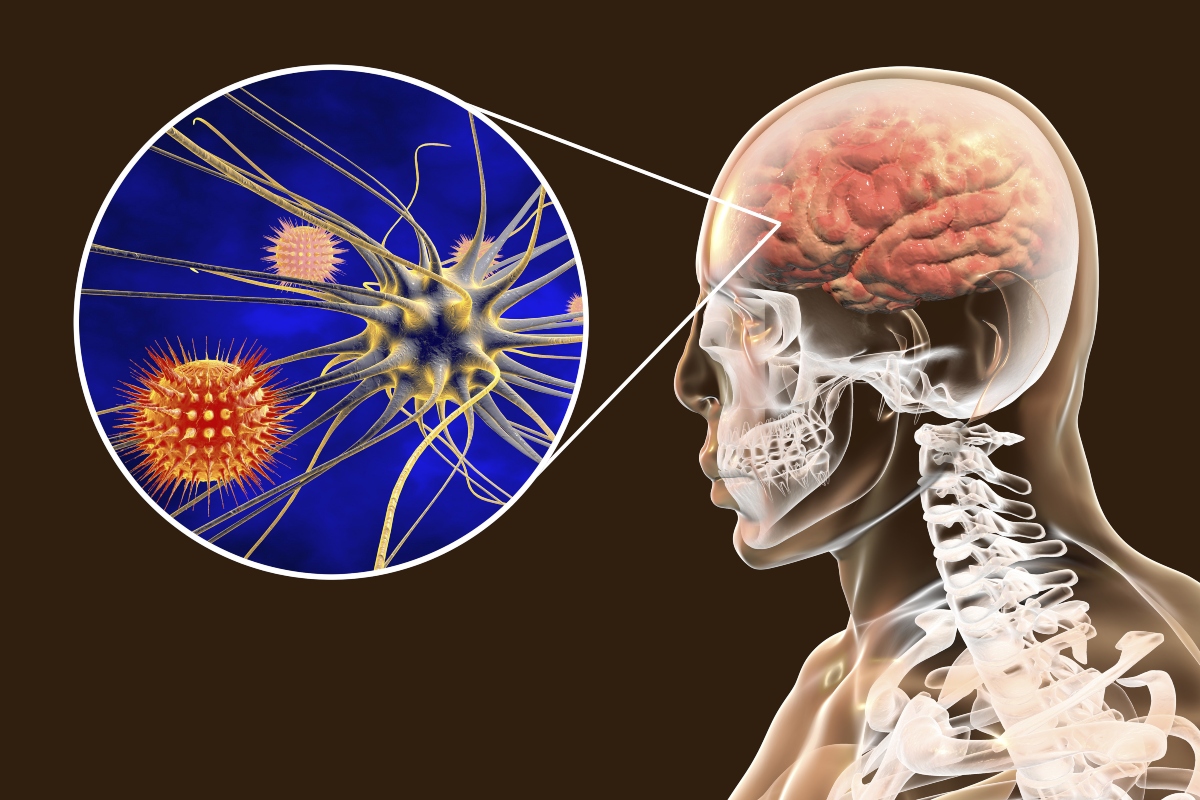 meningite: anatomia