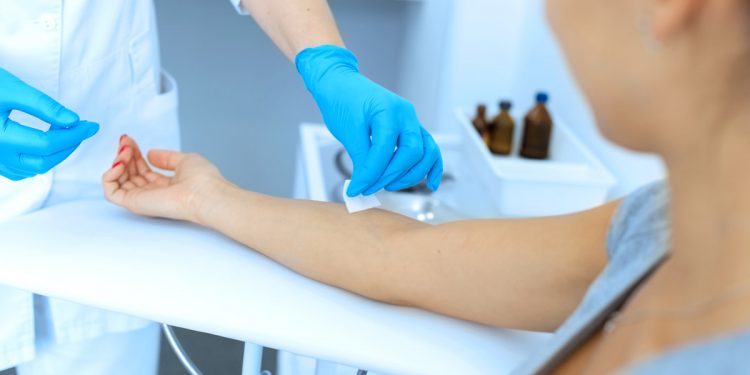 Sclerosi multipla: un esame del sangue può aiutare a prevedere se la malattia peggiorerà